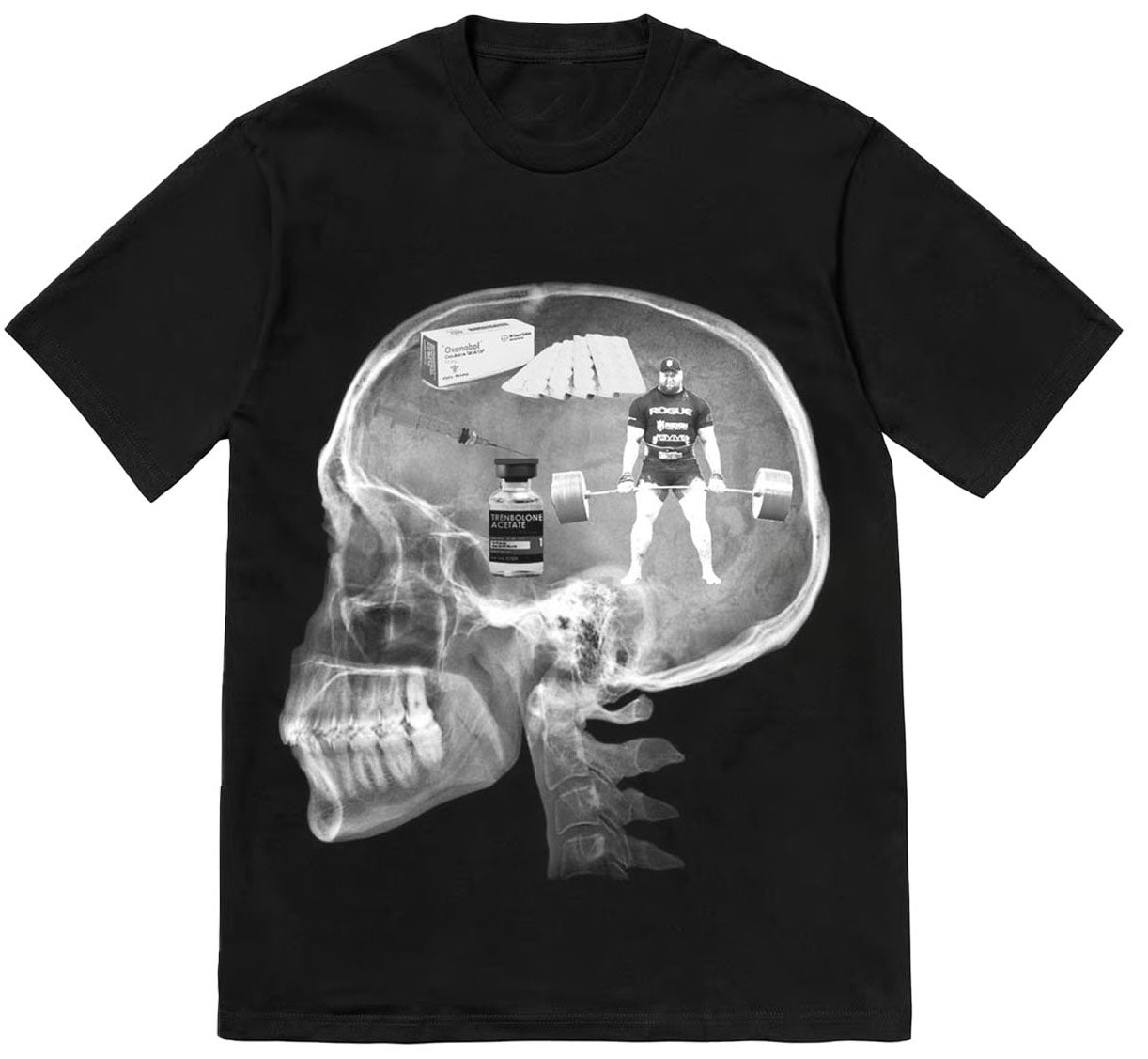 GYM X-Ray HEAD (Black Shirt)
